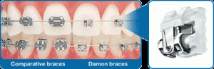 The Damon® System